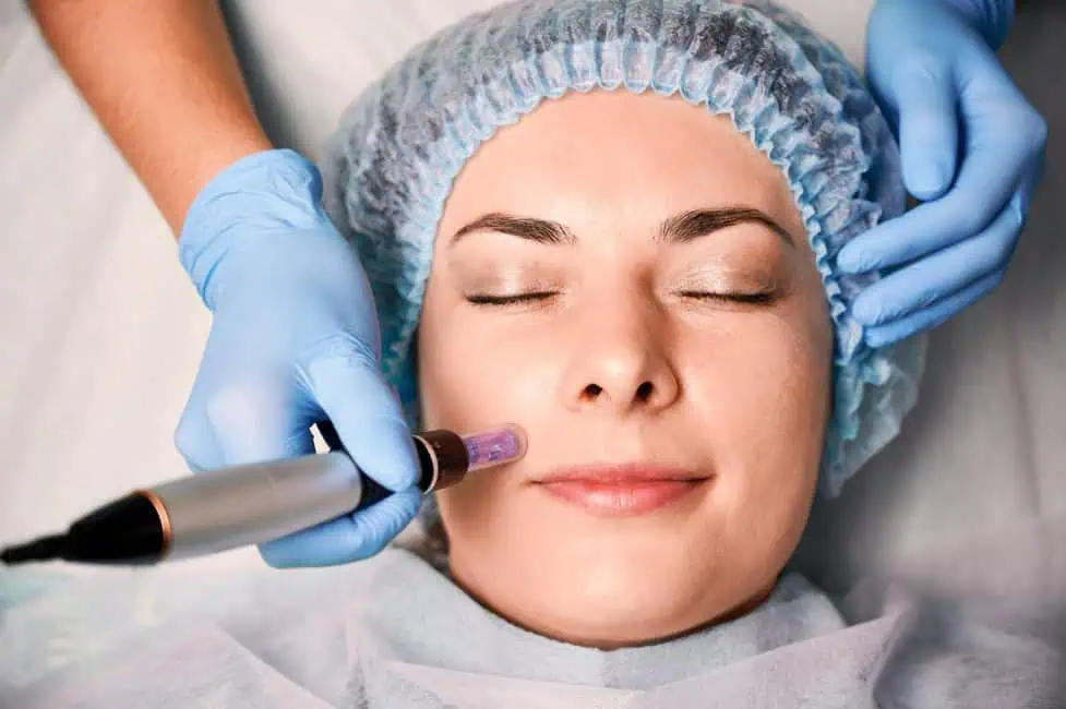 Microdermabrasion by Venus Rising Med Spa LLC in Vancouver, WA