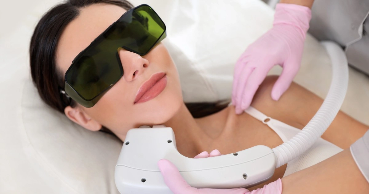 laser hair removal Vancouver WA