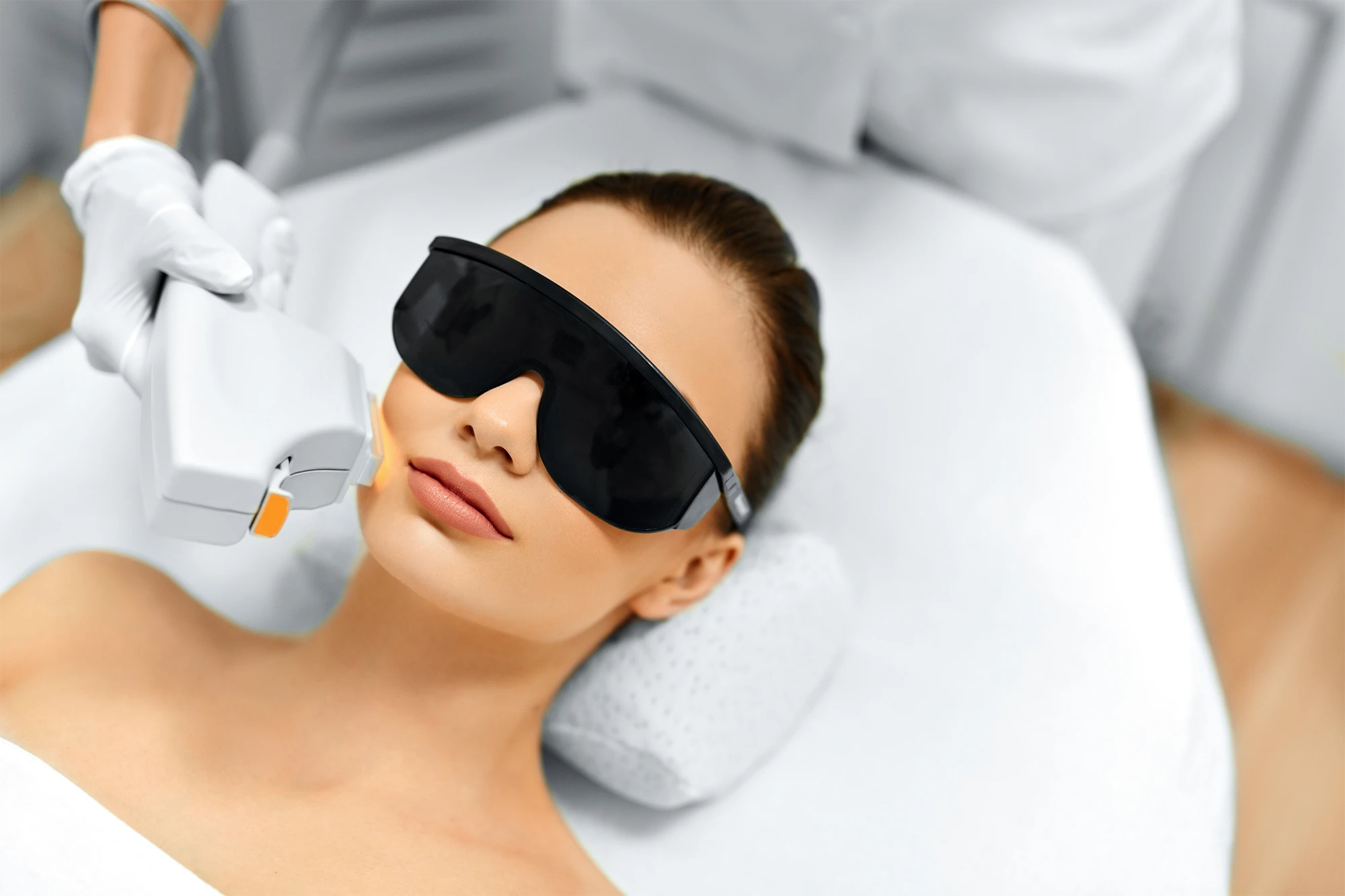 IPL Photo Facial for Sun Damage, Redness, and Pigmentation
