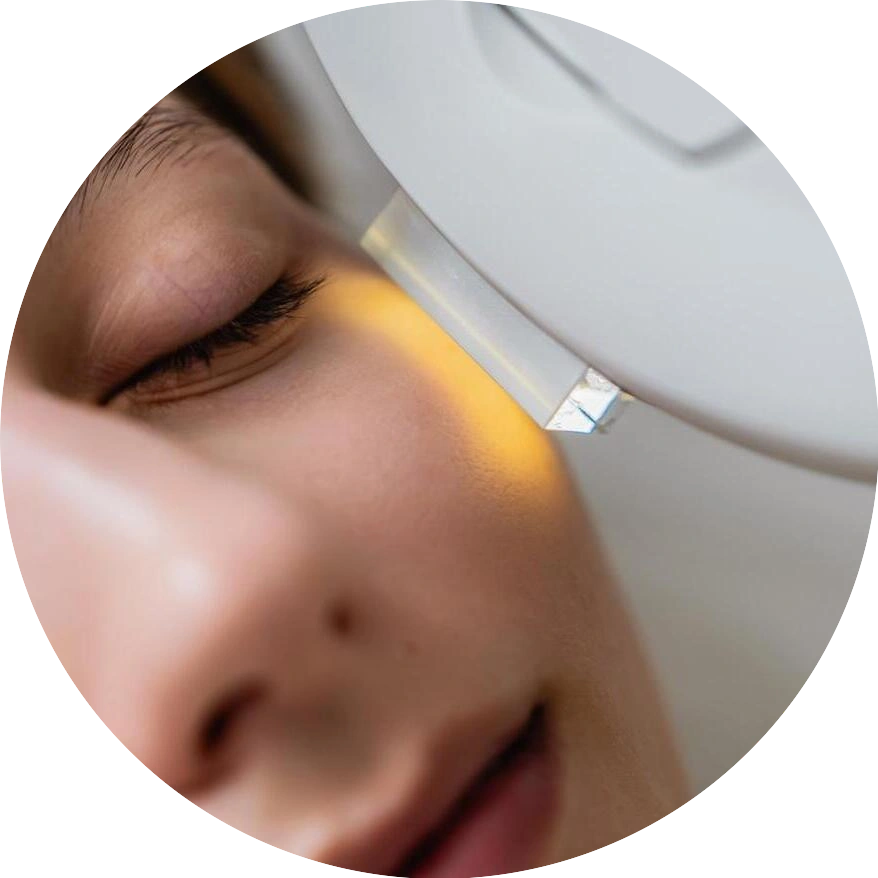 IPL PHOTO FACIAL Membership at Venus Rising Med Spa